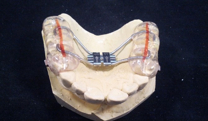 Bonded Hyrax w tubes @ OrthoPrime